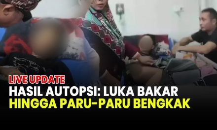 Polisi Kantongi Hasil Autopsi, Ada Luka Bakar Akibat Kekerasan
