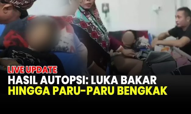 Polisi Kantongi Hasil Autopsi, Ada Luka Bakar Akibat Kekerasan