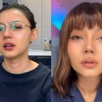 Rina Nose Kini Semakin Cantik Usai Operasi Hidung!