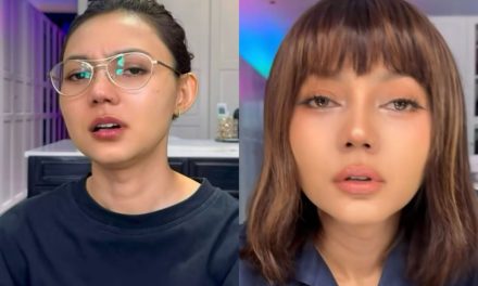 Rina Nose Kini Semakin Cantik Usai Operasi Hidung!
