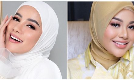 Tren Veneer Gigi: Rahasia Senyum Cantik Ala Selebriti
